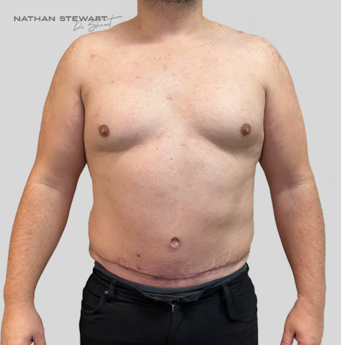 After 6 weeks