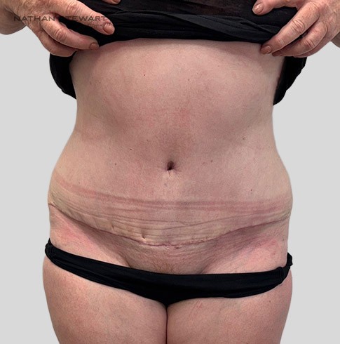After 6 weeks