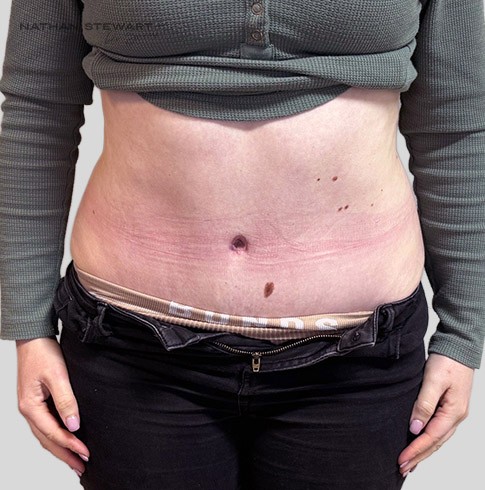 After 6 weeks