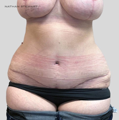 After 6 weeks