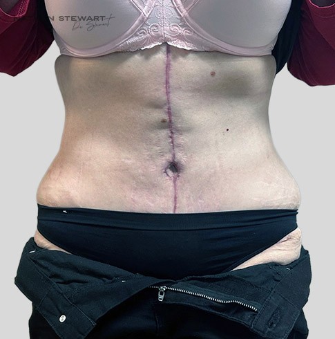 After 7 weeks