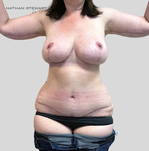 After 6 weeks