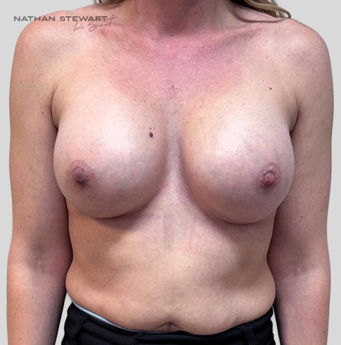 After 6 weeks