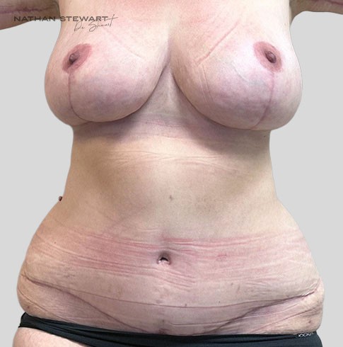 After 6 weeks
