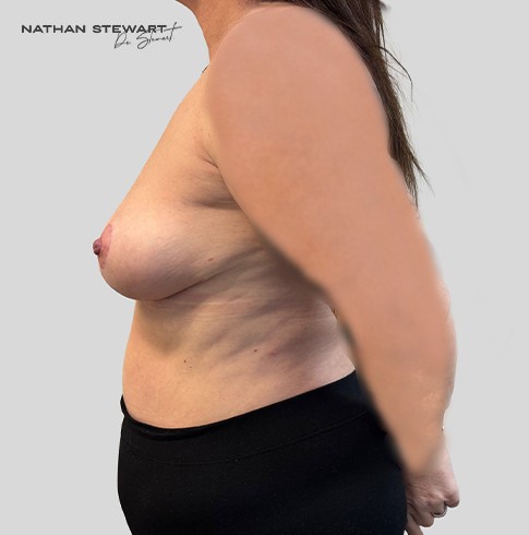 After 6 weeks