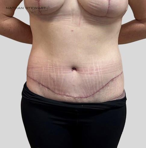 After 6 weeks