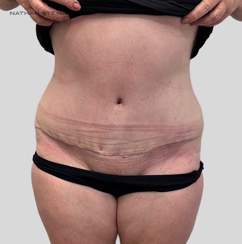 After 6 weeks