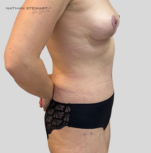 After 6 weeks