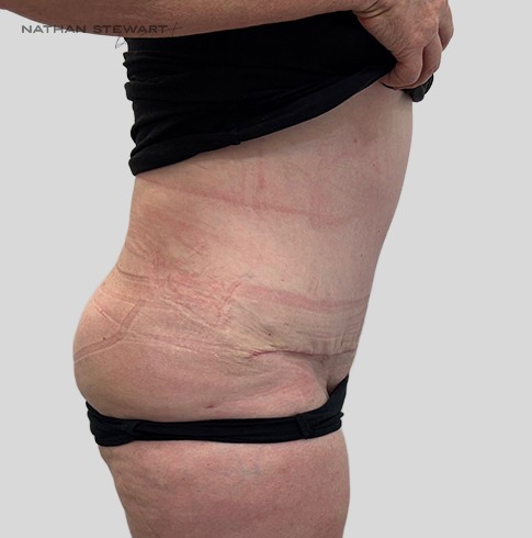 After 6 weeks