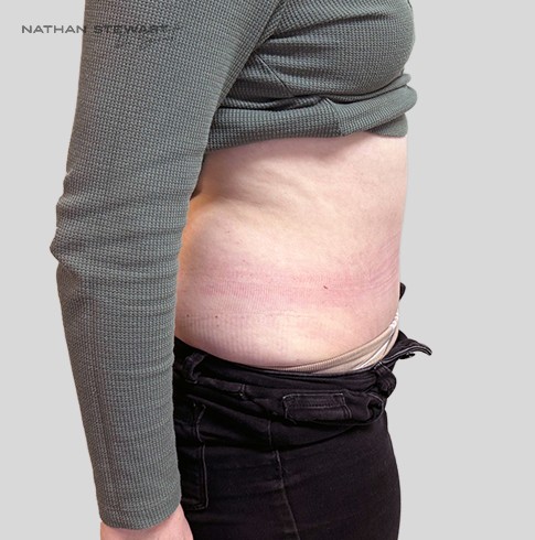 After 6 weeks