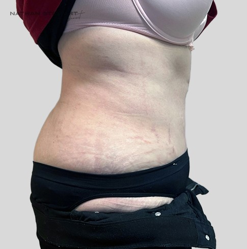 After 7 weeks