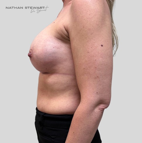 After 6 weeks