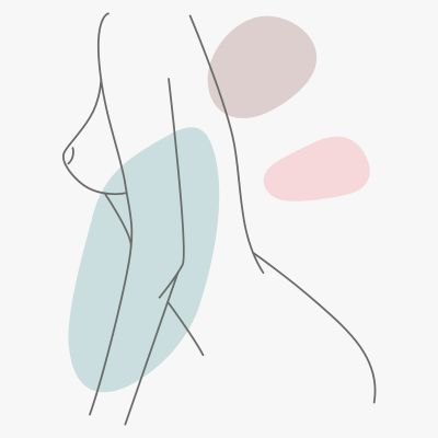 Augmentation Mastopexy Gallery