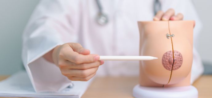 Surgeon explaining a mastopexy procedure using a breast model during a consultation